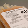close up of Plasma bag, AB blood type