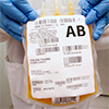 Two hands wearing blue surgical gloves holding plasma bag of AB blood type