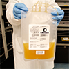 lab technician wearing blue surgical gloves holding Plasma bag with O blood type
