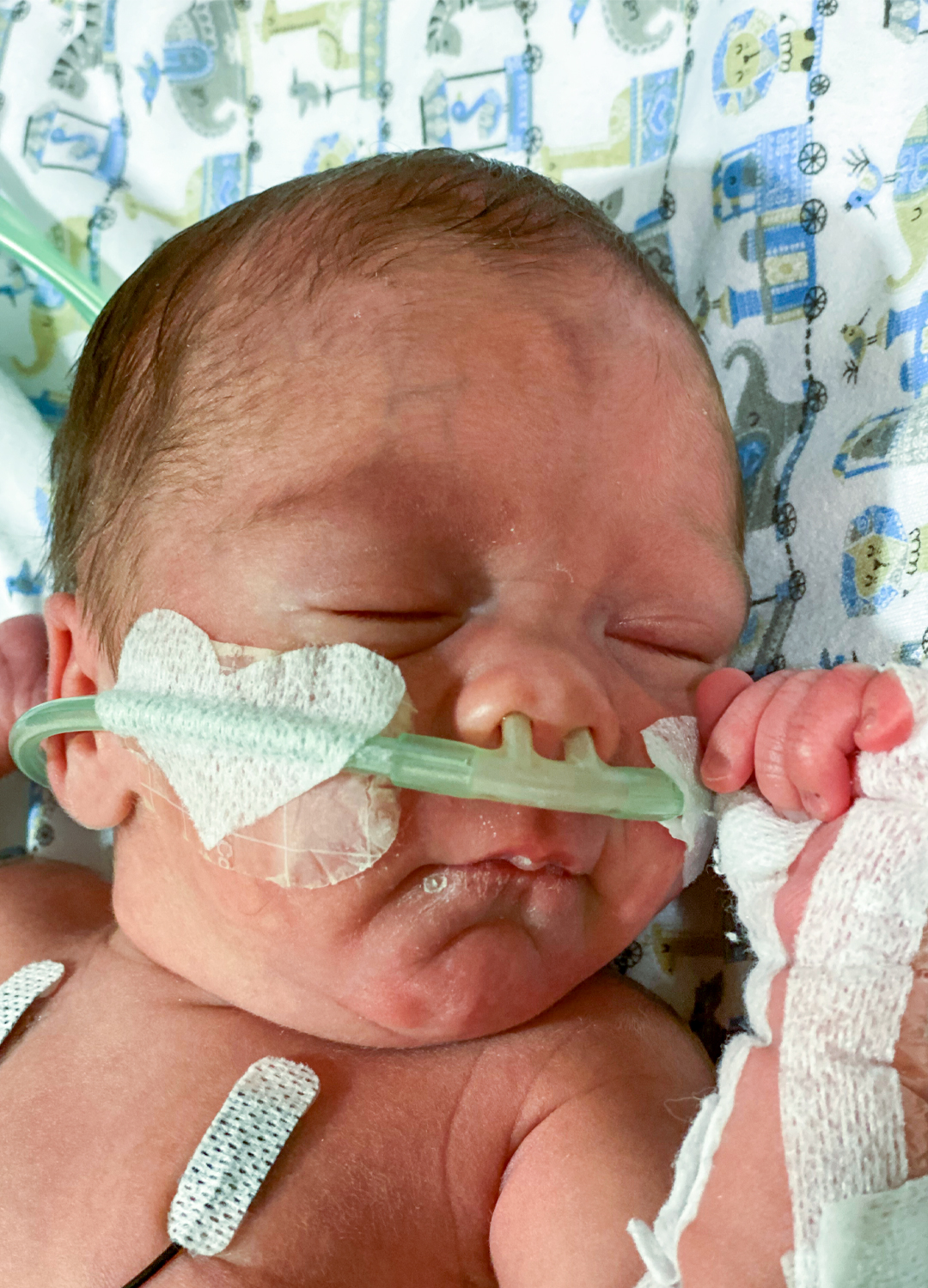 Blood transfusion recipient John-Derrick