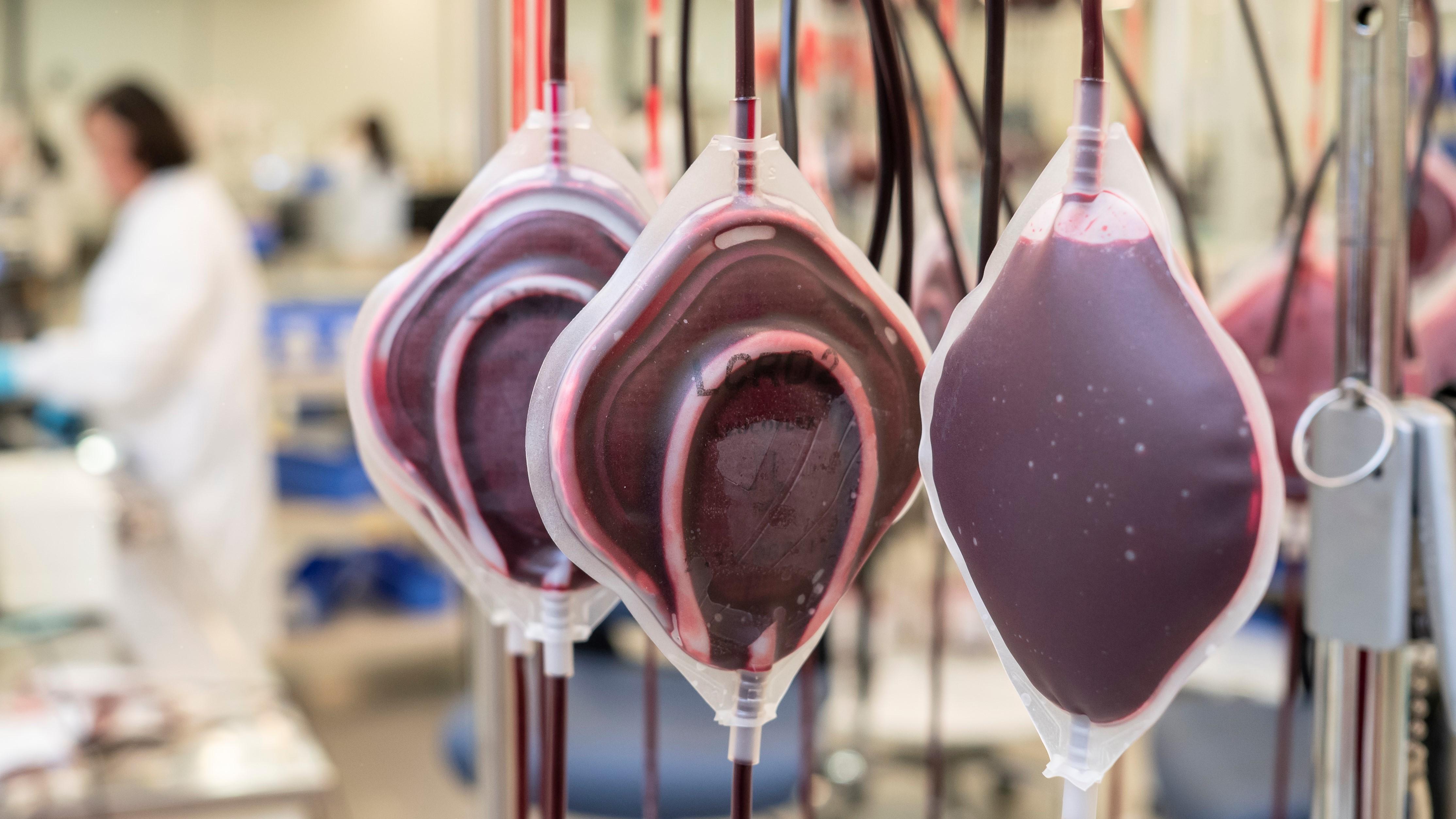Red blood cells hanging to filter at a Canadian Blood Services production facility.