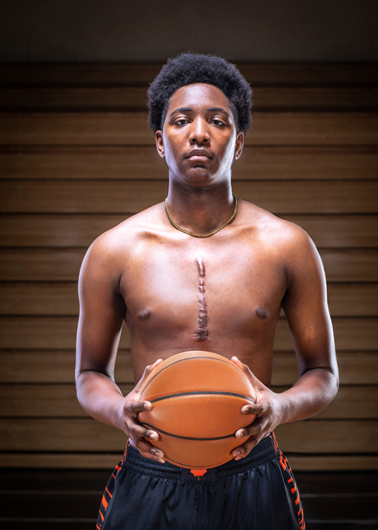 Person with a basketball with a scar in the middle of the chest