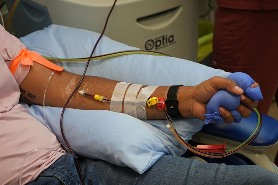 Forearm of man donating stem cells hooked up to apheresis machine