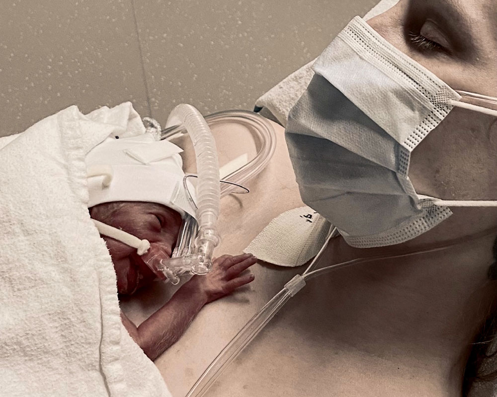 Woman in hospital with infant son with breathing tube on her chest
