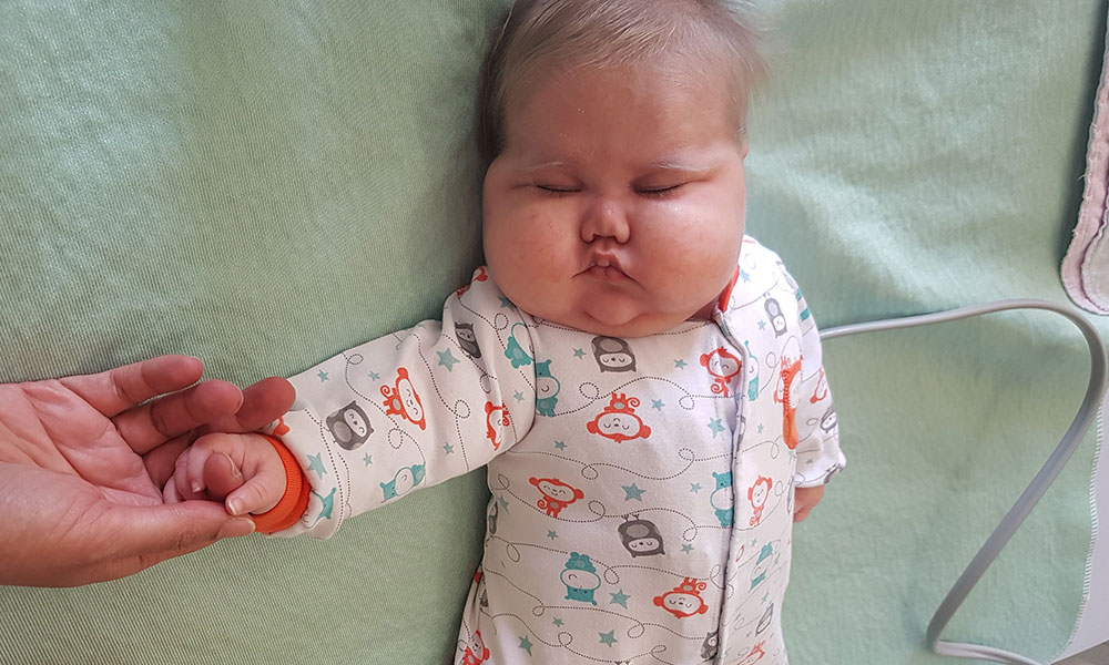 Baby Tristan sleeping on a hospital bed during his cord blood transplant.