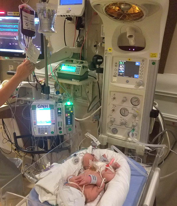 newborn in hospital receiving o-positive blood transfusion