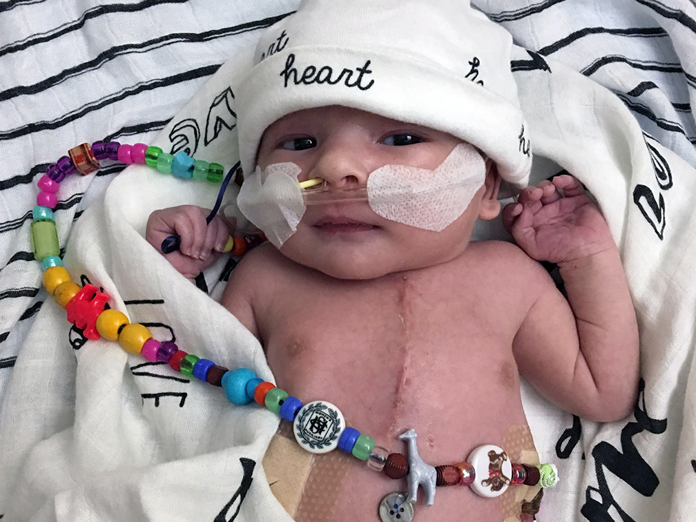 Infant with surgery scar on chest in blanket with string of beads
