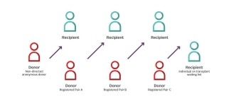 kidney donor domino effect