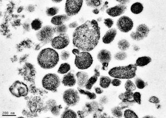 Electron micrograph of microparticles found in the supernatant of a freshly prepared RBC unit. Microparticles ranged from 50-600 nm in diameter, with many around 200 nm.  Photo credit: Adapted from Danesh et al., Blood 123:687-96 (2014).