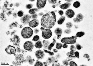 Electron micrograph of microparticles found in the supernatant of a freshly prepared RBC unit. Microparticles ranged from 50-600 nm in diameter, with many around 200 nm. Photo credit: BSRI, Adapted from Danesh et al., Blood 123:687-96 (2014).