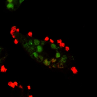 Figure 1 Red blood cells that have been ingested by the macrophage (immune cells) are stained in green and red blood cells that are bound but not ingested by the macrophage are stained red. The orange color is a cell membrane staining dye.