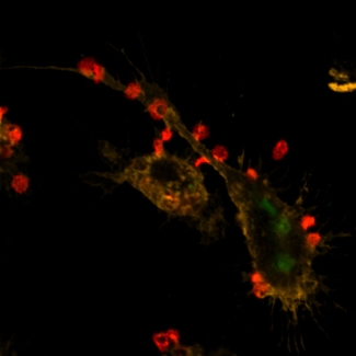 Figure 2 - Anti-CD44 The macrophage in the presence of the control antibody (figure 1) ingested or engulfed more red blood cells (green) than the macrophage treated with the anti-CD44 antibodies (figure 2).