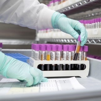 Gloved hands pick up a vial of blood from a rack for testing