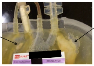 bacterial visible in platelet bacterial visible in platelet