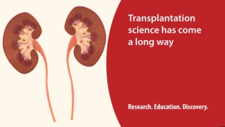 Transplantation card with text reading: &quot;Transplantation science has come a long way. Research. Education. Discovery.&quot; and image of two kidneys