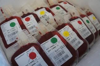 pediatric blood bags used in study pediatric blood bags used in study