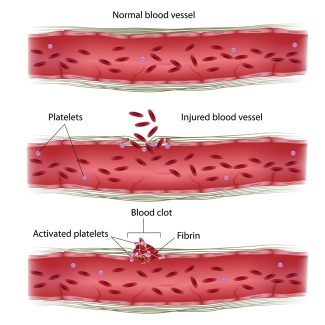 how platelets form clots how platelets form clots