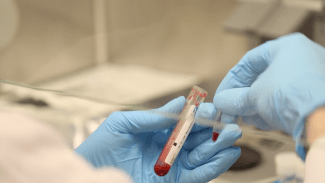 Two hands holding a test tube filled with cord blood