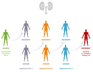 Kidney Paired Donation - how it works Kidney Paired Donation - how it works