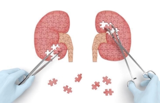 kidney piece puzzle kidney piece puzzle