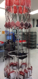 Blood is suspended so that it flows through the leukoreduction filter. Thank you, gravity! The leukoreduction filter traps the white blood cells and is discarded. The red blood cells and other important blood components collect in a new bag.