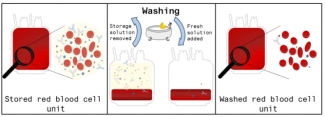 Red blood cell washing process RU 23 washing red blood cells