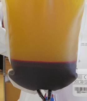 Whole blood unit separated into plasma, platelets, and red blood cells