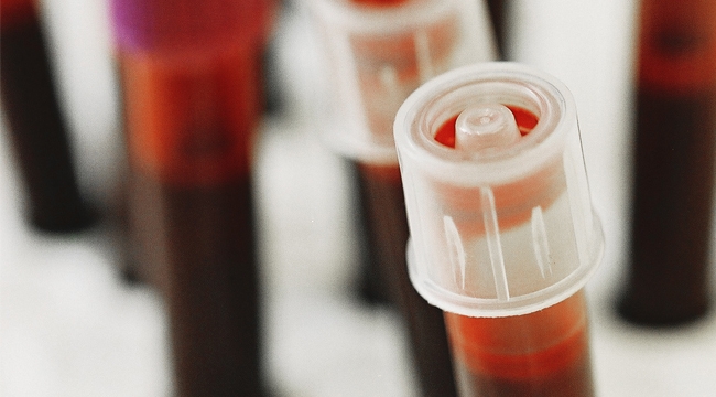 Vacutainer tubes with blood